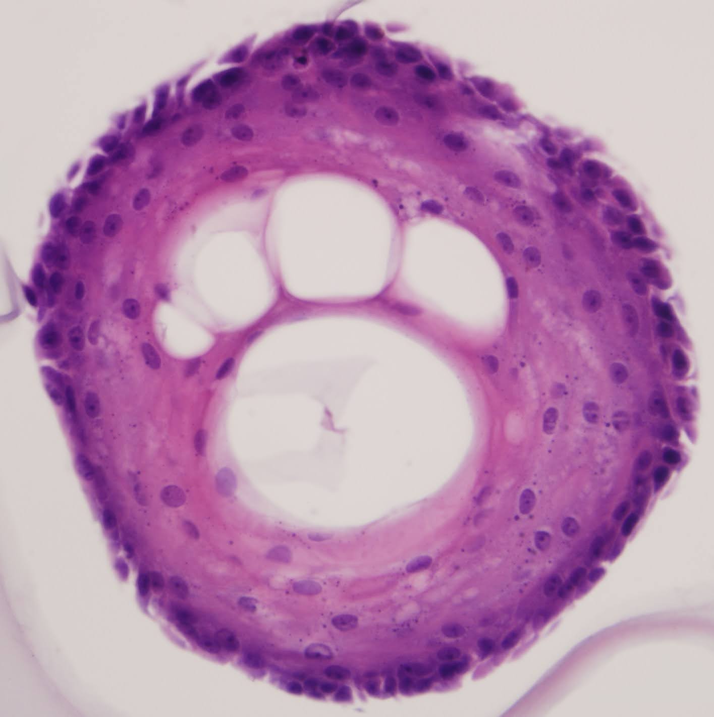 Footprint organoid